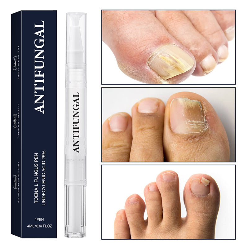 ✨ Nieuwe Binnenkomers 🔥 Pen voor de behandeling van teennagelschimmel voor beschadigde nagels